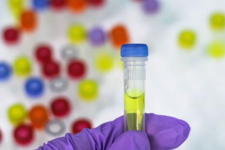 PCR-Test PCR-Test